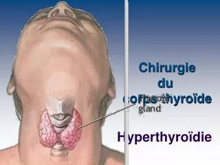 chirurgie du corps thyro de