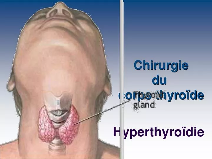 chirurgie du corps thyro de