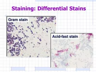 Staining: Differential Stains