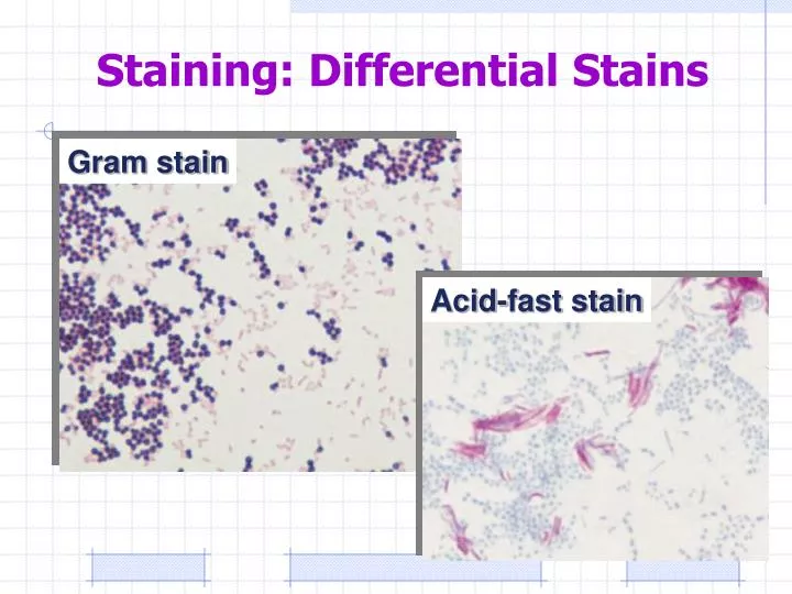 staining differential stains