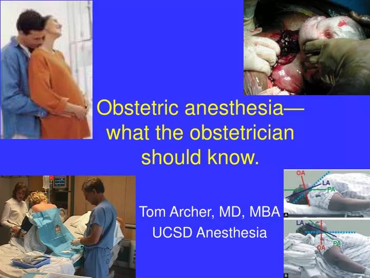 obstetric anesthesia what the obstetrician should know