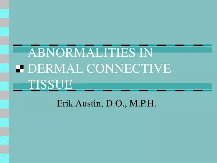 abnormalities in dermal connective tissue