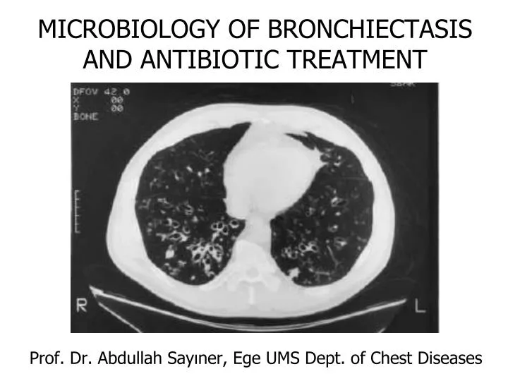 microbiology of bronchiectasis and antibiotic treatment