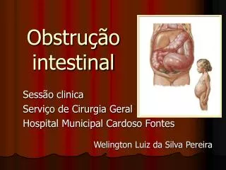 obstru o intestinal