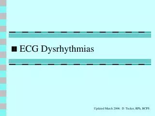 ECG Dysrhythmias