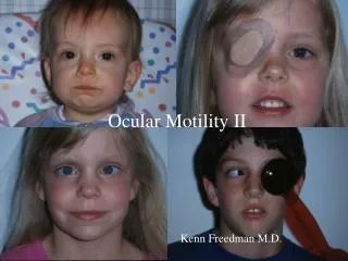 Ocular Motility II