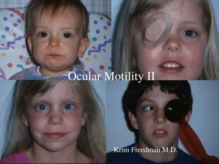 ocular motility ii