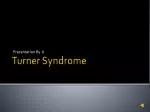 Turner Syndrome - slide 1