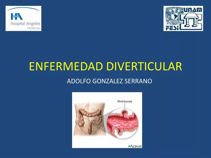 enfermedad diverticular