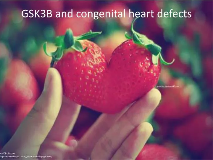 gsk3b and congenital heart defects