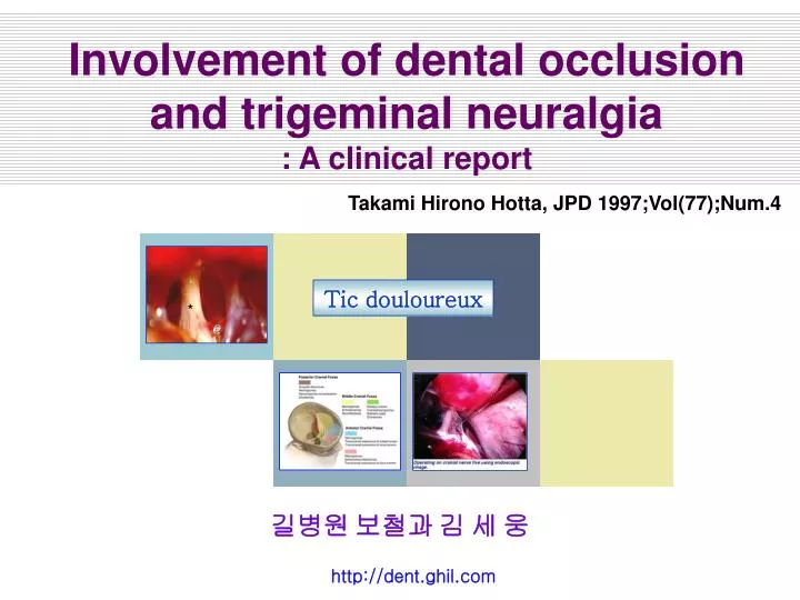 involvement of dental occlusion and trigeminal neuralgia a clinical report