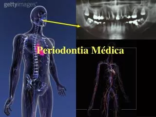 periodontia m dica