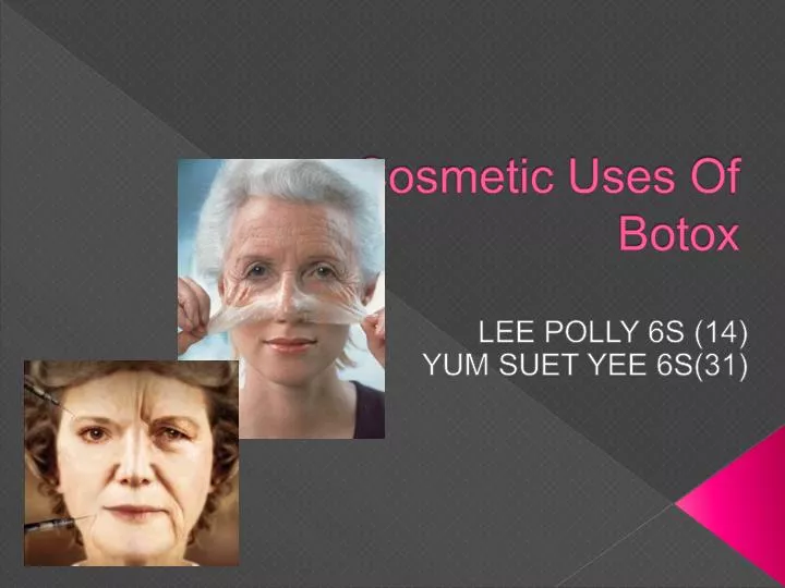cosmetic uses of botox