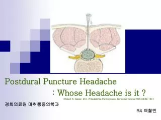 Postdural Puncture Headache : Whose Headache is it ?