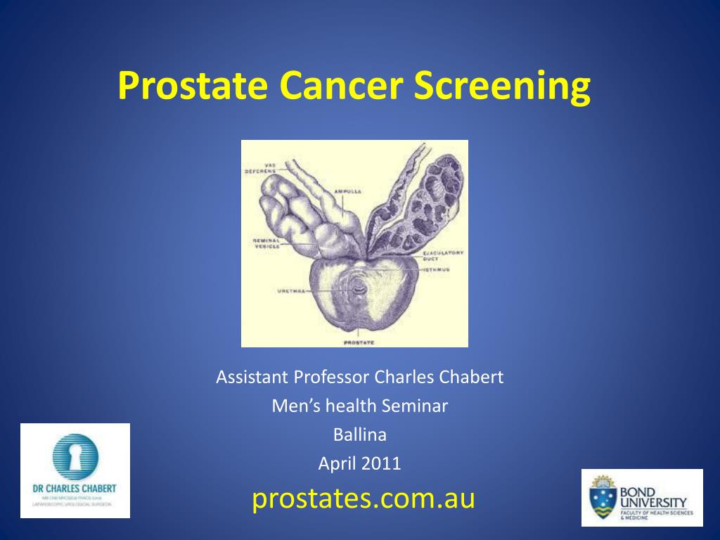 PPT - Prostate Cancer Screening PowerPoint Presentation, free download ...