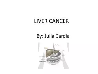 LIVER CANCER