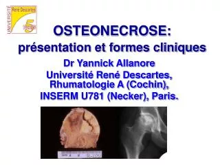 osteonecrose pr sentation et formes cliniques