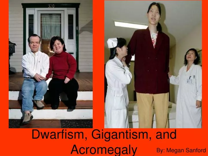 dwarfism gigantism and acromegaly