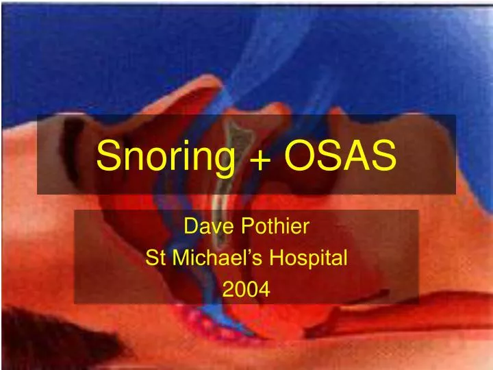 snoring osas