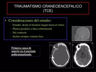 traumatismo craneoencefalico tce