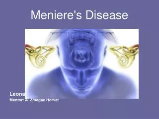 Meniere's Disease