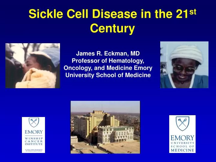 sickle cell disease in the 21 st century