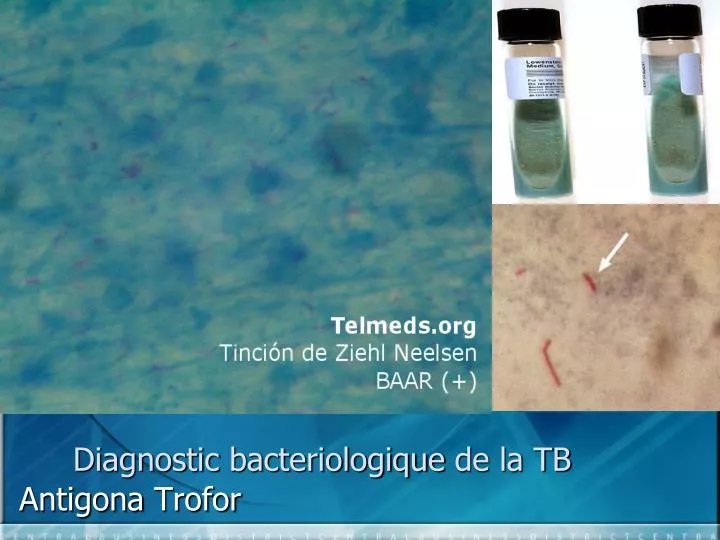 diagnostic bacteriologique de la tb