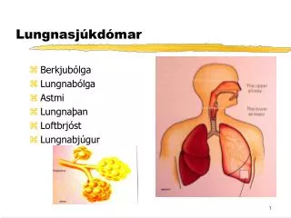 lungnasj kd mar