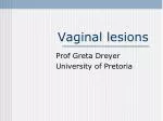 Vaginal lesions - slide 1