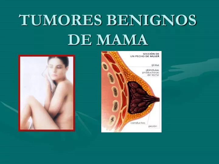 tumores benignos de mama