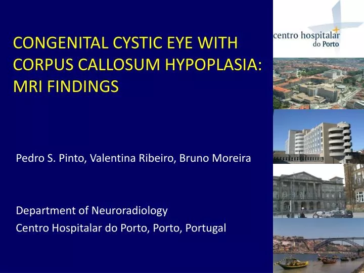 congenital cystic eye with corpus callosum hypoplasia mri findings