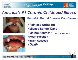 Pediatric Dental Disease Can Cause: