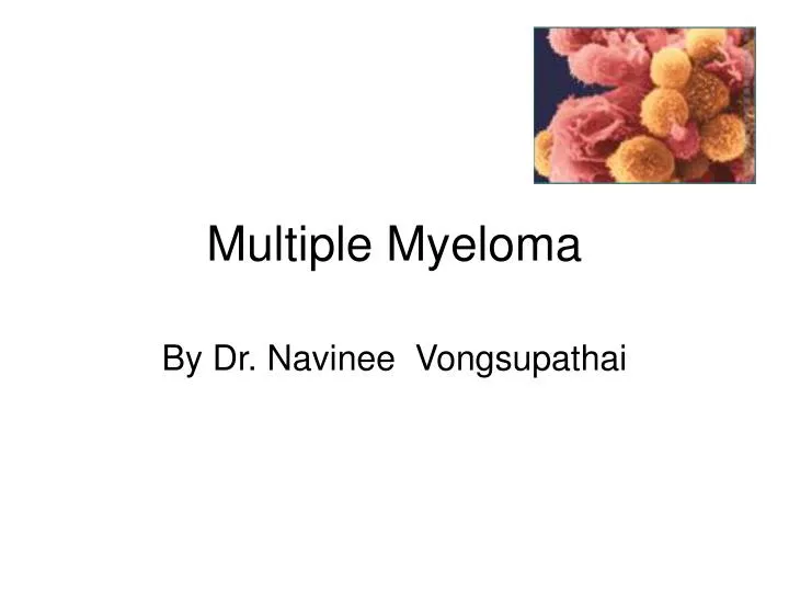 multiple myeloma