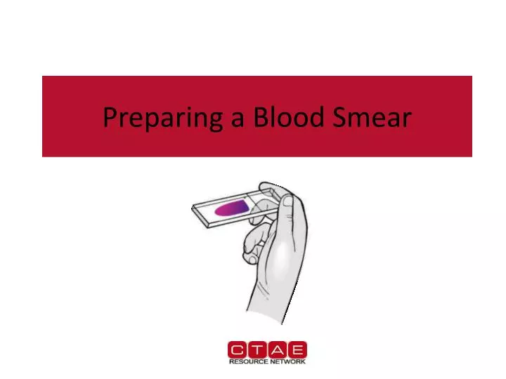preparing a blood smear
