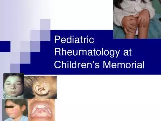 Pediatric Rheumatology at Children’s Memorial