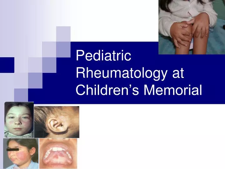 pediatric rheumatology at children s memorial