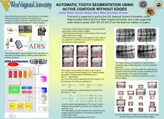 AUTOMATIC TOOTH SEGMENTATION USING ACTIVE CONTOUR WITHOUT EDGES
