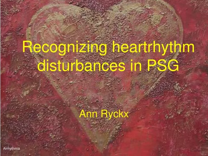 recognizing heartrhythm disturbances in psg