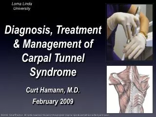 Diagnosis, Treatment &amp; Management of Carpal Tunnel Syndrome