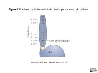 GI Motility online (May 2006) | doi:10.1038/gimo31