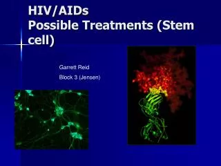 HIV/AIDs Possible Treatments (Stem cell)