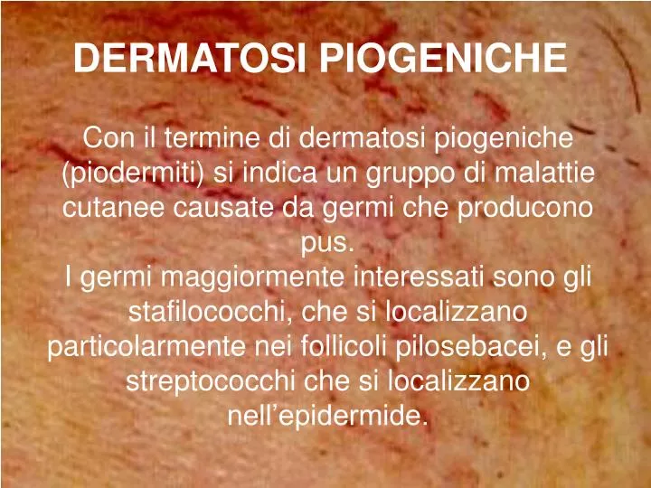 dermatosi piogeniche