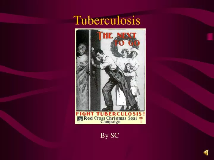 tuberculosis