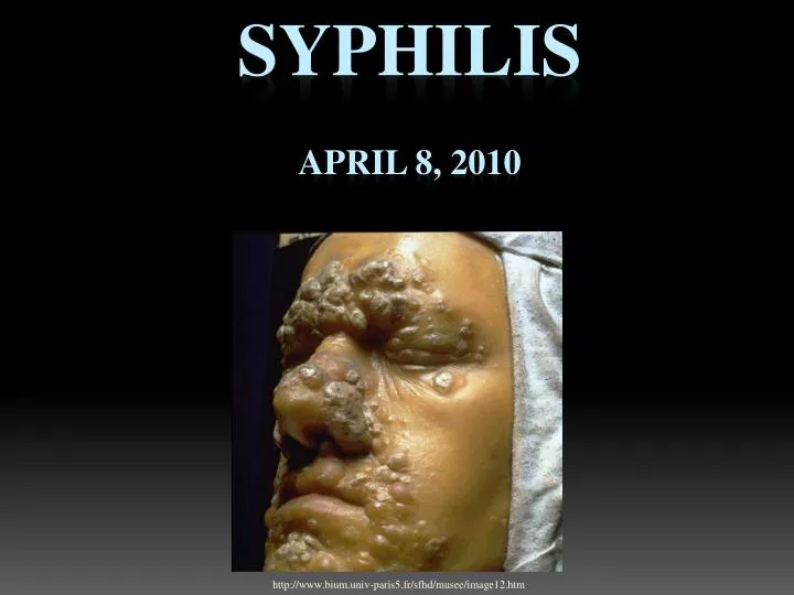 syphilis april 8 2010