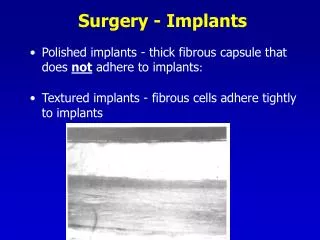 Surgery - Implants