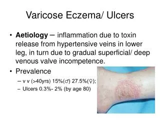 Varicose Eczema/ Ulcers