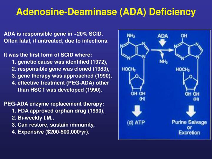 adenosine deaminase ada deficiency