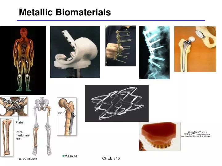 metallic biomaterials