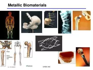 Metallic Biomaterials