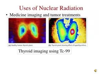 Medicine imaging and tumor treatments